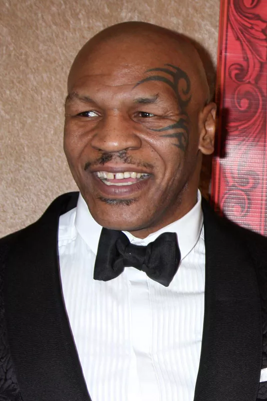 Mike Tyson after dental work